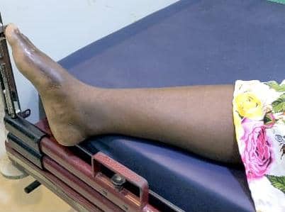 Trois semaines après l'accident survenu le 1er décembre 2025 impliquant le véhicule de l'humoriste Fingon Tralala au quartier