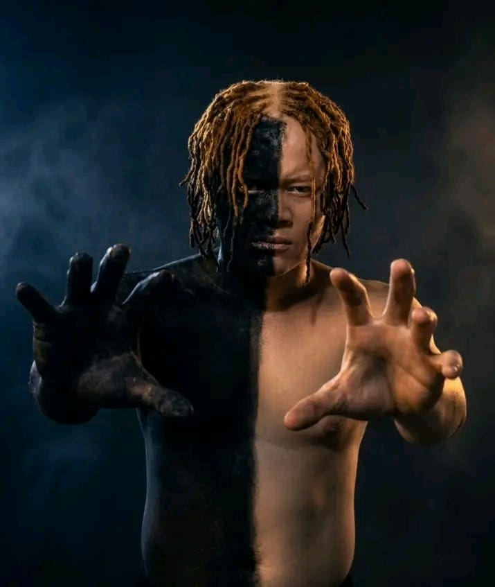 L'artiste musicien camerounais Boy Tag expose les épreuves liées à son albinisme